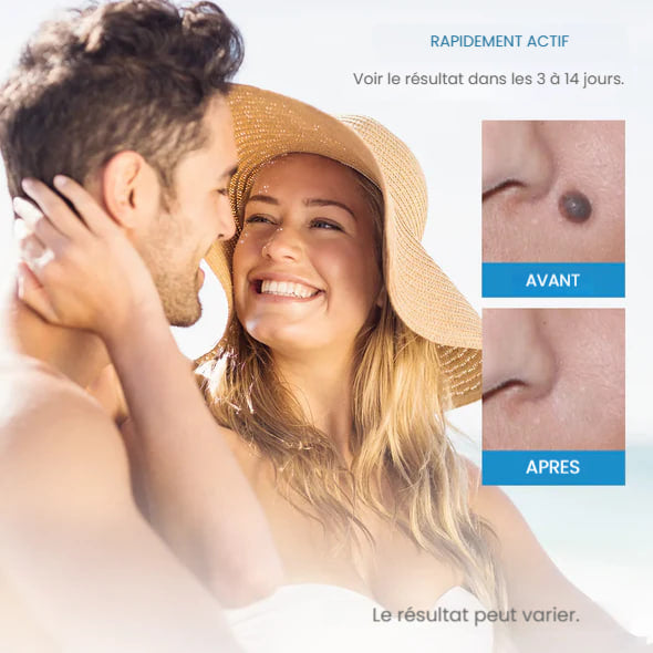 Kit PureDerm™ - Extracteur d'acrochordons